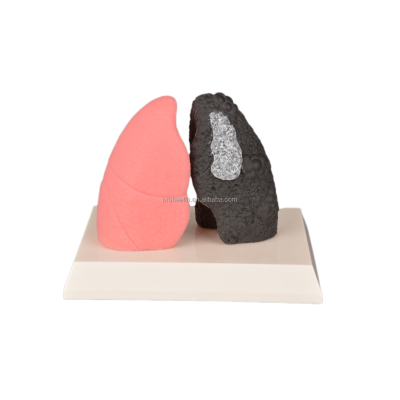 Small Size Silicone Smoker's Lung Model for Education Healthy Lung Demonstration