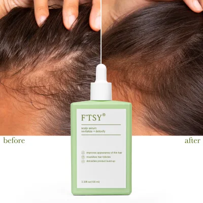 Private Label Caffeine Vegan Rosemary Anti Hair Loss Advanced Hair Growth Serum Hair Serum