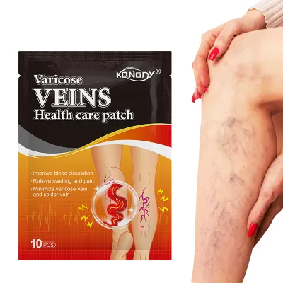 Support Customize  Varicose Vein Cream  Spider Varicose Veins Patch for Pain