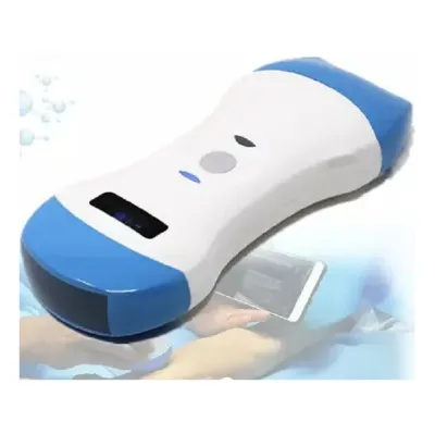 Hot Sale Portable WiFi Wireless Convex Probe Electric Plastic Color Doppler Ultrasound Premium Medical Instrument