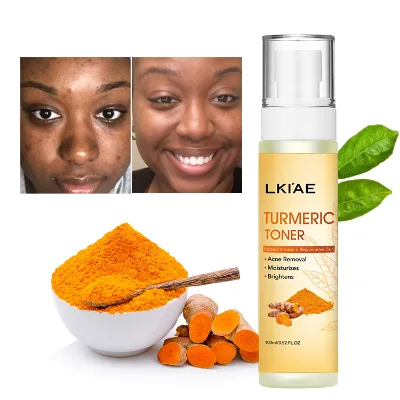 High Quality Natural Organic Vitamin C Refershing Moisturizing Mint Turmeric Whitening Facial Toner for Face