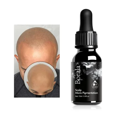 Scalps Micropigmentation Spmu Pigment for Scalp Pigmentation