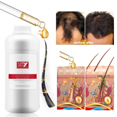 1 Liter Natural Hair Growth Nutrient Solution for Hair Loss Treatment