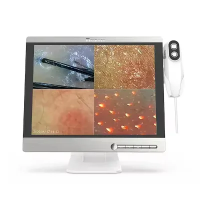 Wholesale Price M15 Factory price OEM/ODM Dermatoscope AI Intelligent Report Analysis Scalp Analyzer Beauty Salon