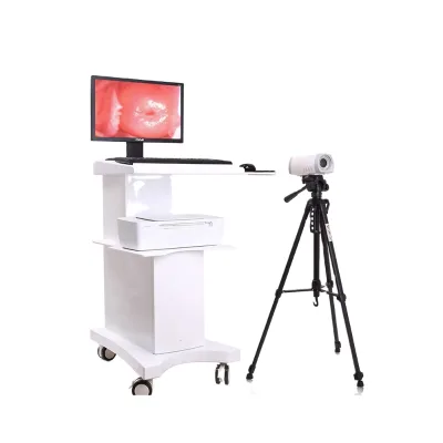 IN-9800A  Cheapest Digital Video Colposcope Portable Handheld Video Colposcope