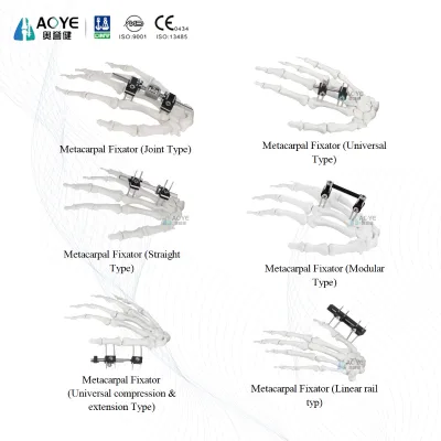 Factory Direct Supply Surgical Fracture Mini Finger External Fixator Orthopedic Instrument for Hand Fracture Surgery