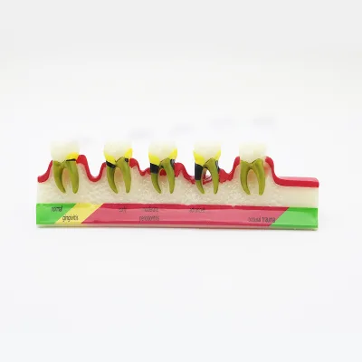 High Quality Dental Orthodontic Teeth Model Teaching Study Tooth Medical Science Disease Dentist Dentistry Products