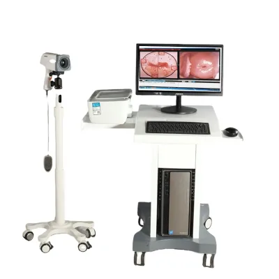 KN2200 Medical Gynecology High-definition Digital Imaging System Vaginal Vulvouterine Disease Examination System Equipment
