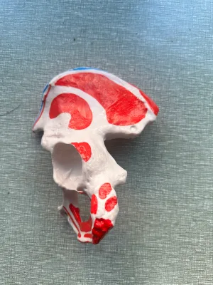 PVC Hip Joint Skeleton Model with Colored Muscles