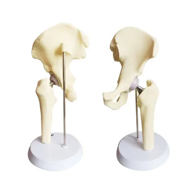 Mini Hip Replacement Hip Implant Resin ABS Skeleton Model for Orthopedic