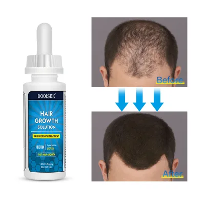 Wholesale Hair Growth Serum Anti Hair Loss Fast Repairing Ginger Vitamin Care Essential Hair Growth Serum Oil