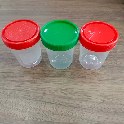 120ml Urine Stool Specimen Container Non-Sterile Medical Consumables Urine Container Hot Sell in Argentina