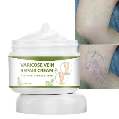 50g Healthcare Supply Herbal Medicine Intravenous Cream Varicose Veins Varicosity Phlebitis Spider Leg Veins Massage Cream