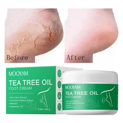 Foot Cream With Tea Tree Oil, Aloe & Spearmint - Hydrates, Softens & Conditions Dry Cracked Feet, Heel and Calluses Foot Cream