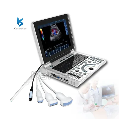 Laptop Basic High Definition Display Portable Human Diagnostic Equipment Hospital Clinic Ultrasound Device