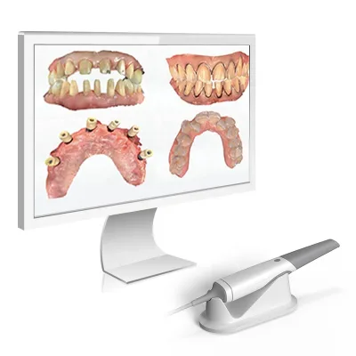 Automatic Anti-fogging Ergonomically Designed Portable Dynamic 3D Dental Intraoral Scanner Shinning for Dental Clinic