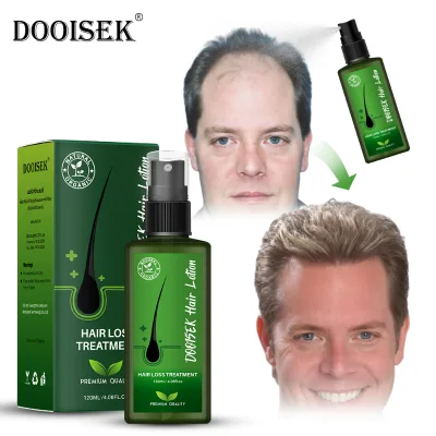 Private Label Wholesale Hair Growth Lotion 120ml Hair Growth Oil for Men Women Hair Root Growth Serum