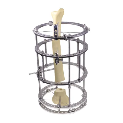 Hip Joint Configuration Pelvic Fragment Femoral External Fixator Ilizarov External Fixator