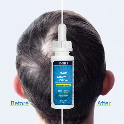 Quality Wholesale Anti Hair Loss Treatment Hair Growing Biotin Hair Growth Serum Set Hemp Essential Oil With Hot Sale