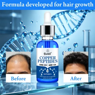 BUNEE GHK-Cu AHK-Cu Copper Peptide Hair Density Serum GHK-Cu Copper Peptide Serum for Hair Growth Hair Thinning & Loss