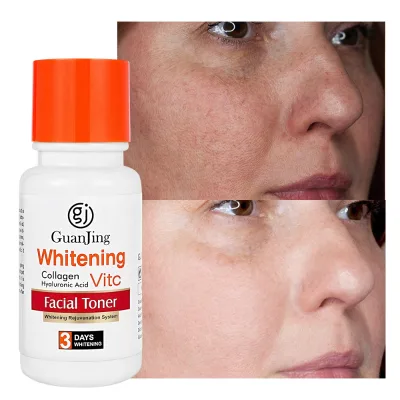 OEM Private Label Organic Face Care Whitening and Brightening Vitamin C Skin Toner Hydrating Facial Toner for Acne Skin New