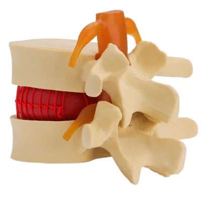 1.5X Intervertebral Disc Model Anatomical PVC Lumbar Spine Model Elastic Software Medical Science for Body Human Disc Herniation
