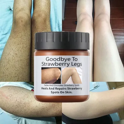 Strawberry Legs Exfoliating Bleaching Cream for Dark Skin Fast Effective Removal of Pore Black Spots Lotion Whitening Cream