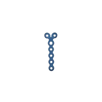 Innovative Phalangeal Metacarpal T-shaped Locking Plate 1.5 for Superior Fixation