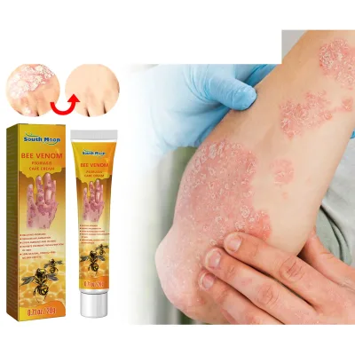 Professional Quality Body Psoriasis Tinea Itch Ointment Excellent Moisturizing and Repairing Bee Venom Skin Protection Cream