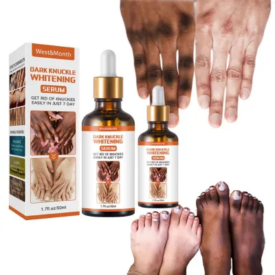 OEM/ODM Fast Action Skin Whitening Serum Anti-Aging Dark Spot Correcting Glow Anti-Wrinkle Vitamin C & Hyaluronic Acid Body 50mL