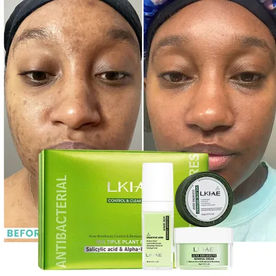 OEM Factory Dark Skin Luxurious Cosmetic Products Serum Soap Cream Remover Pimples Smooth Anti-Aging Firming Dry Face Care Set