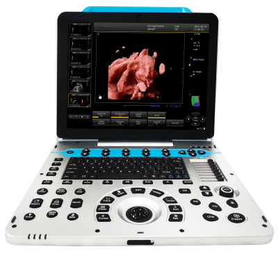 Ultrasonic Diagnostic Doppler Ultrasound Equipment  3D 4D Echocardiography Ultrasound Medical Instruments Machine