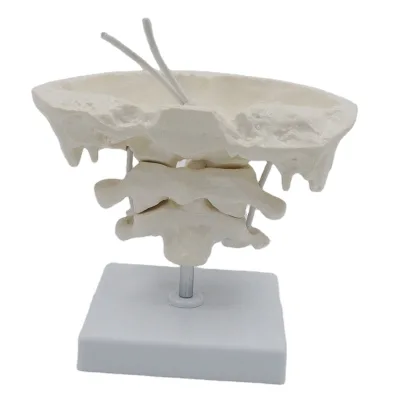 Flexible Human Occipital Bone Medical Anatomy Model With Atlas and Armature