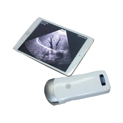 Low Price Mini Laptop New Full Digital Portable Ultrasound Machine/Ultrasonic Scanner/Echo Machine