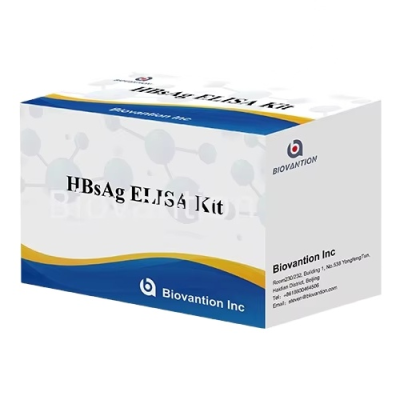 Elisa Diagnostic Kit Hbs Ag