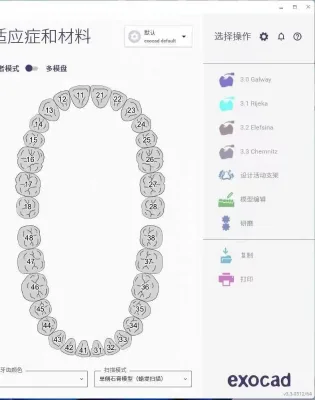 Chemnitz Dental Software Lab CAD Systems Class II Plastic Material Lifetime Use No Annual Fee Free Time Use CE Certified 1000W 1