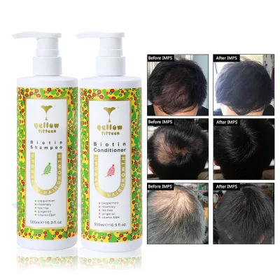 Low Moq Thickening Hair Growth Anti-loss Professional Hair Care Biotin Shampoo