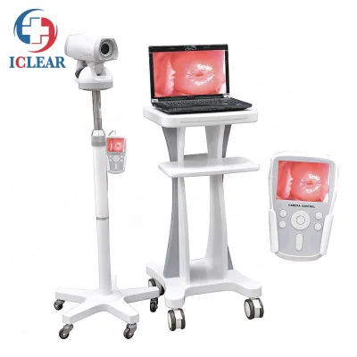 Cost-effective Medical Digital Video Colposcope Gynecology Colposcope