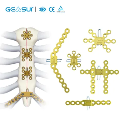 Orthopedic Titanium Alloy Star Locking Plate Trauma Bone Fracture Internal Fixation Implan