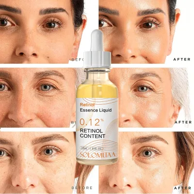 Retinol Serum for Face Serum, Hyaluronic  Acid for Smoothing Fine Lines, Dark Spot & Anti Aging Anti Wrinkles Facial Serum