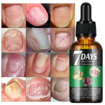 7 Days Remove Onychomycosis Foot Protector Fungal Nail Treatment Repairing Serum