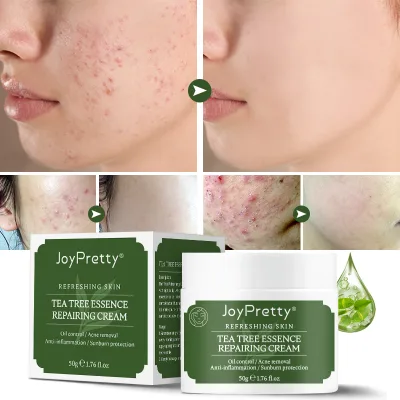 Wholesale Natural Tea Tree Face Cream Repairing Skin Anti Acne Cream Acne  Face Care Whitening Cream