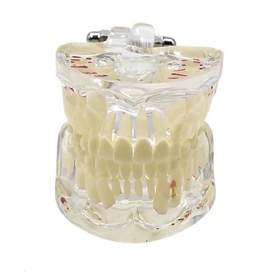 Children Dental Teaching Model, Transparent Anatomy Tooth Model for Dental Education
