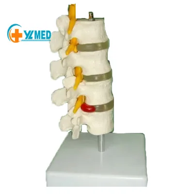 Medical Science Human Normal Lumbar Set 4 Pcs Lumber Skeleton Model for Teaching and Learning