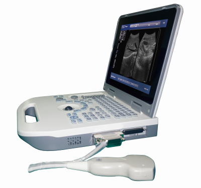 Ultrasound Handheld Device Portable Ultrasound Ultrasound Machine