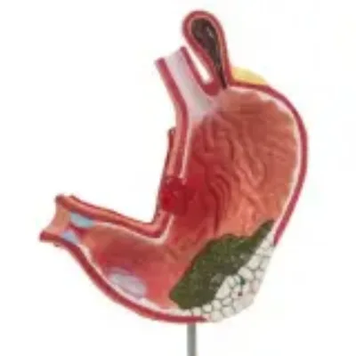 D021G Stomach Lesion Model