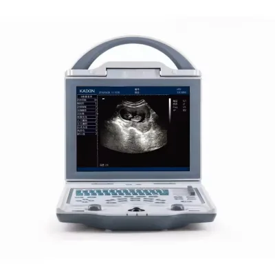 Medical Ultrasonic Equipment Full Digital B/W Mode Ultrasound System Price Portable Ultrasound Machine