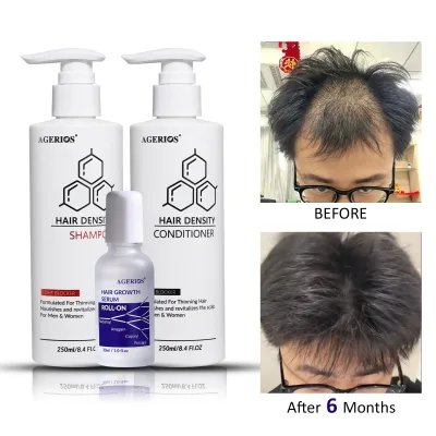 Private Label Hair Growth Set Redensyl Capixyl Procapil Anagain Shampoo Conditioner Serum Kit for Thicker Hair OEM