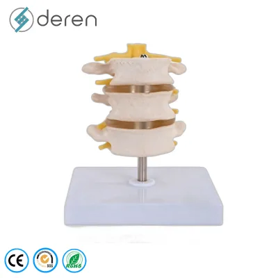 Life-Size Flexible Spine Model Nerves Painted Muscles Femur Heads PVC Environmental Soft Silicone Educational Model for Medical