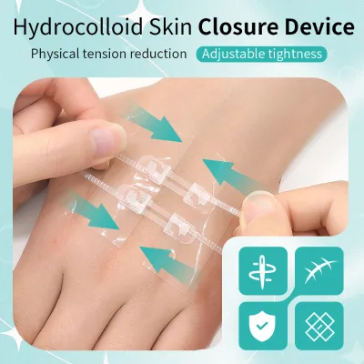 Hydrocolloid Wound Closure Strip Hypoallergenic Waterproof Adhesive Individually Packaged Skin Healing Patch CE Certified Class